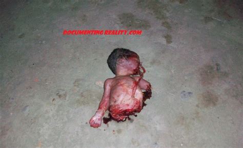 Failure of pregnancy is usually the entire process of mummification takes several weeks, depending on the age of the fetus at the time of fetal mummification is to be differentiated from fetal maceration, in which the fetus putrefies, in. Dead Babies