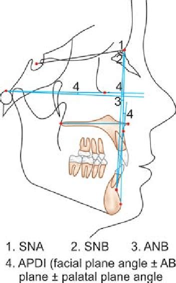 From my point of view, eating healthy food plays an essential role in everyday life. Skeletal horizontal parameters | Download Scientific Diagram