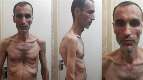 Example sentences from the web for emaciated. Photos show former Iranian VP Hamid Baghaei emaciated from ...