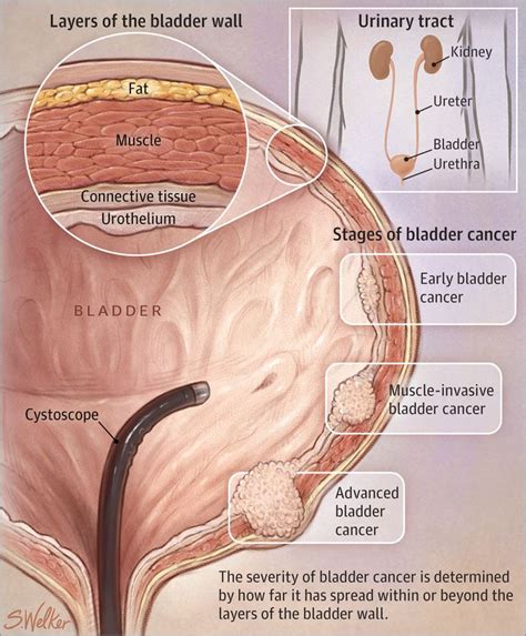 You're losing weight without trying. 31 best Acknowledge Yourself with Urinary System ...