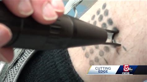 We did not find results for: This cutting edge tattoo ink can disappear, if you change your mind - YouTube