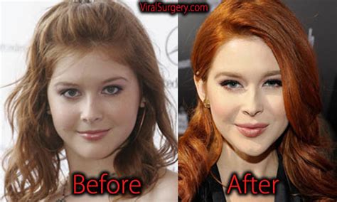 *free* shipping on qualifying offers. Renee Olstead Plastic Surgery: Before After Botox, Boob ...