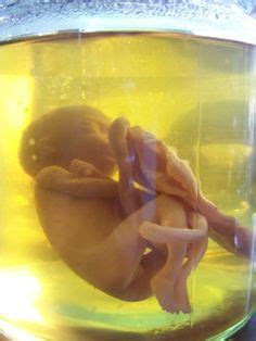 Find the best baby bath tub and make bath time fun time. 16 Best alyssa's project images | Baby in womb, Human ...