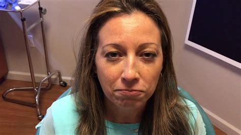 So, when you smile, your skin won't fold while botox for smile lines gives results, some people combine the treatment with skin resurfacing procedures. Botox for Gummy Smile Testimonial in Dallas, TX - YouTube