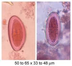 The pinworm has a worldwide distribution and is the most common helminth infection in the united. Brain & Soul Energy: Enterobius vermicularis