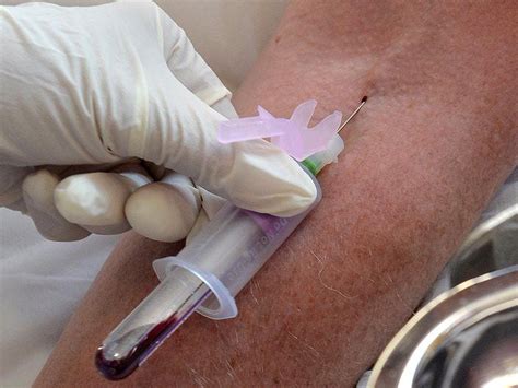 Help diagnose cancer and other conditions. Blood test 'can detect more than than 50 types of cancer ...