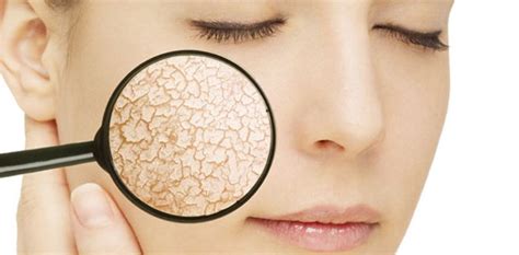 Kulit kering adalah masalah yang berlaku apabila lapisan atas kulit (epidermis) tidak terhidrat dengan baik. Cara Mengatasi Kulit Wajah yang Kering - Info Pendidikan ...