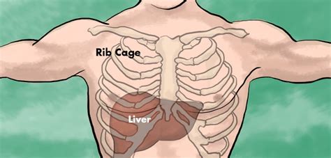 Rib cage pain may start in one area but travel to an area nearby. Liver Pain: Location, Causes and Treatment