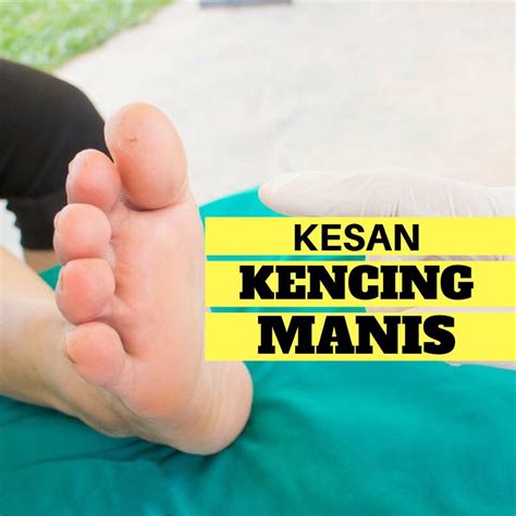 Inggeris = diabetes mellitus merupakan sejenis penyakit yang dapat dicirikan dengan keadaan hiperglisemia (tinggi kandungan glukosa dalam darah), terutamanya selepas pengambilan makanan, pada penghidapnya. KESAN-KESAN BURUK KENCING MANIS | Clear Herbs