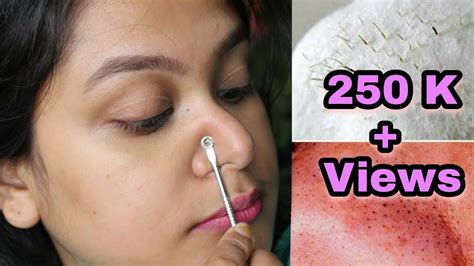 Home remedies to remove blackheads naturally. HOW TO REMOVE BLACKHEADS INSTANTLY & PERMANENTLY ...