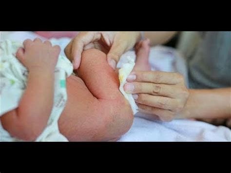 Najis bayi baru lahir (mekonium). bayi: bab bayi warna hijau tua