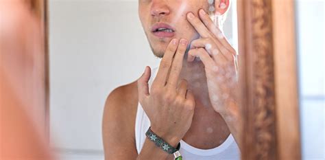 Visible signs of infection are treatable with antibiotics and by mechanically removing the trapped hair with 'acne surgery, says green.and if you notice reinfected ingrown hairs ( a condition known as folliculitis) see your doctor, who will generally treat it with a. This Ingrown Hair Removal Is the Gift that Keeps on Giving ...