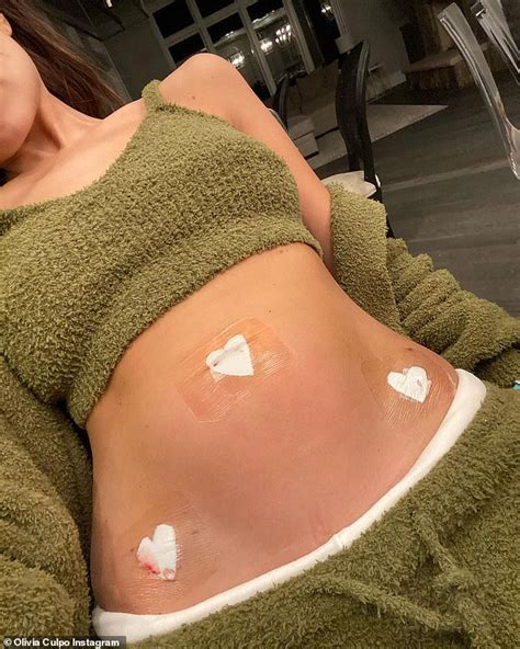 Endometriosis implants, however, are not the only cause of endo belly. Olivia Culpo reveals she has undergone surgery for ...