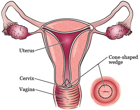 A typical gesture begins at the point that the screen is first touched and ends when the last finger or pointing device leaves the display surface. The bully of the cervix! - Graphic Mirror Online