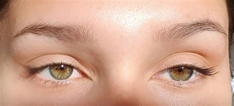 Please use images freely in essays, blogs, etc. Is it central heterochromia? : heterochromia