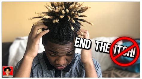 How To Solve Itchy Dreads! | Dreadlocks - YouTube