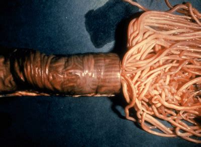 Kommt es nach dem kontakt mit geflügel die vogelgrippe tritt überwiegend bei geflügel auf, der mensch erkrankt vergleichsweise selten an der. Gesundheit / Ernährung & Verhalten/Erziehung » Wurminfektion