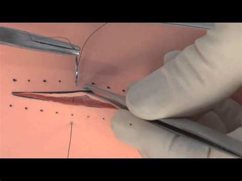 Michael ross demonstrates the vertical mattress suture pattern. SIM SUTURE - 6. The Vertical Mattress Suture - YouTube