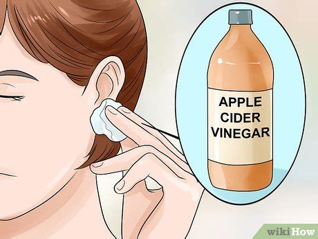 What is the cause of lump under skin of earlobe? 3 Ways to Get Rid of Pimples Inside the Ear - wikiHow