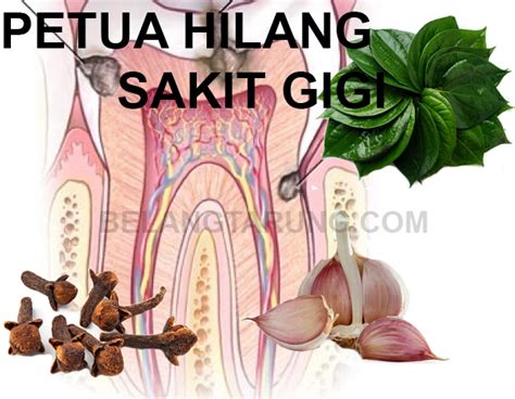 Selain ubat sakit gigi yang anda boleh dapat di klinik gigi atau farmasi, anda juga menggunakan alternatif lain yang mudah stresnya gigi berlubang! Petua Hilangkan Sakit Gigi Berdenyut Dengan Cara ...