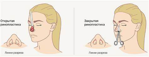 Диета по уменьшению порций