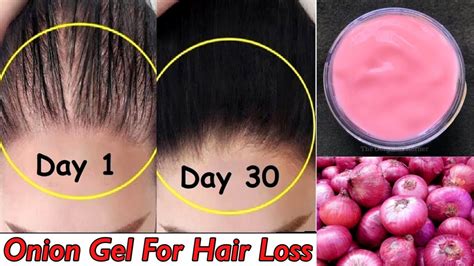 This is ideal for improving blood circulation to the scalp, providing enough oxygen and nutrients to the roots and stimulating the regeneration of hair fibers. Onion For Hair Growth | DIY Onion Hair Gel | Grow Long ...