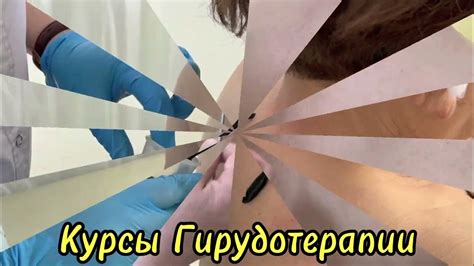 Курсы гирудотерапии,апитерапии.👣Адрес:ул.Маркова 28,ниже Тимирязева 2 ...