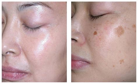 Selain itu, cosmoderm juga mempunyai set penjagaan badan yang meliputi losyen badan. Petua Menghilangkan Jeragat Di Muka Dengan Lebih Berkesan