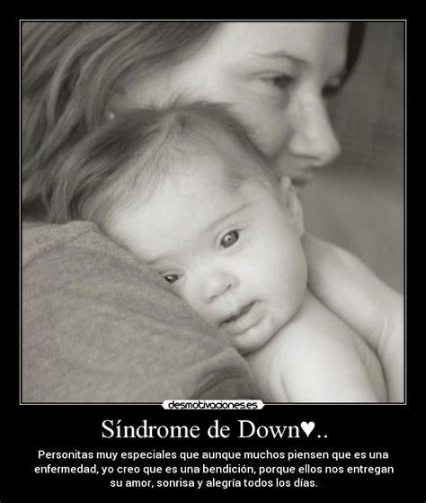 A condição está geralmente associada a atraso no desenvolvimento infantil. Síndrome de Down♥.. | Desmotivaciones