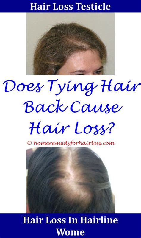 The body needs certain nutrients to produce more red blood cells and if there is a lack of one or more of these nutrients, anaemia will develop. Hair Loss From Anemia Treatment