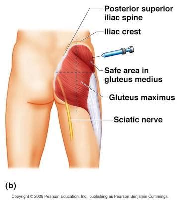 How to give a b12 injection. Why Doctors & Nurses Inject The Buttocks More - Health ...