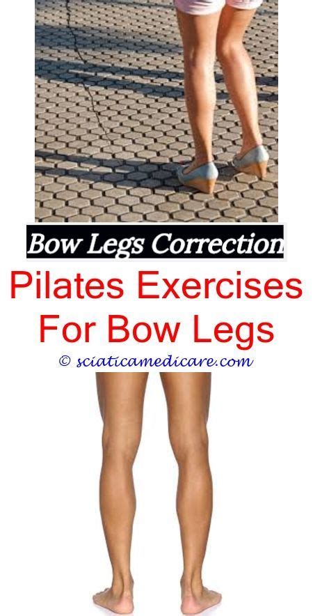 You can't get surgery to fix a lisp. How To Fix Bow Legs In Adults