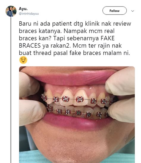 Check spelling or type a new query. Gadis Ini Pesan Elak Pasang 'Fake Braces' Dekat 'Butik ...