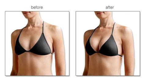These bras are a new favourite. Push Up Bra, Before After (22 Photos)