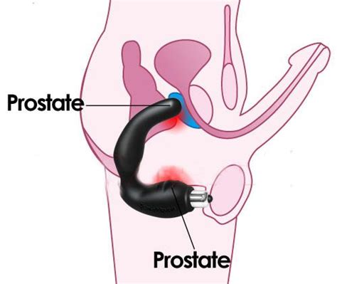Prostate massage might offer help for prostatitis and other health conditions. Erotic prostate milking by women - XXX photo