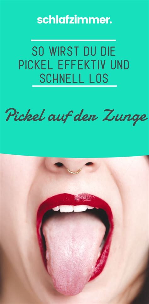 Denn jegliche nahrungsaufnahme wird von einem unangenehmen und. Pickel auf der Zunge: So wirst du die Pickel effektiv und ...