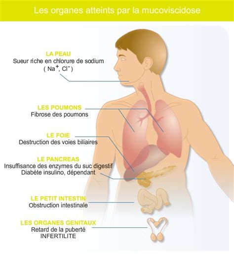 Elle se présente dès le plus jeune age sous forme de diarrhée chronique, d'infections pulmonaires, de respiration difficile, et de toux en l'absence de fièvre. Ensemble contre la mucoviscidose | Le Petit Monde de Oli Dolly