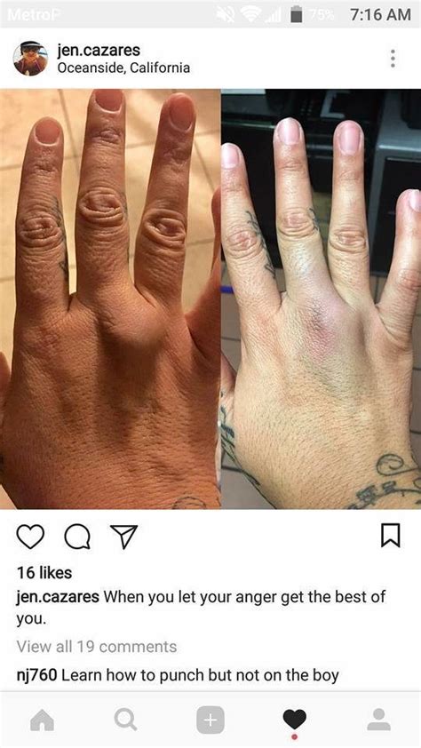 Sometimes it's hard to tell whether your knuckle is actually broken or if it's simply bruised. She Punched Her Son So Hard She Broke Her Hand. Then She ...
