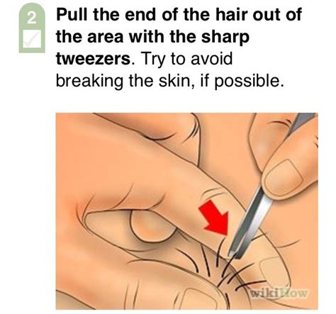 Use a sharp razor and always shave in the direction of hair growth. How to Get Rid of Ingrown Pubic Hair - Musely