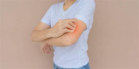 Alergi dingin sebabkan kulit gatal dan bentol ini cara. 7 Obat Gatal Alergi, dari Alami hingga Medis
