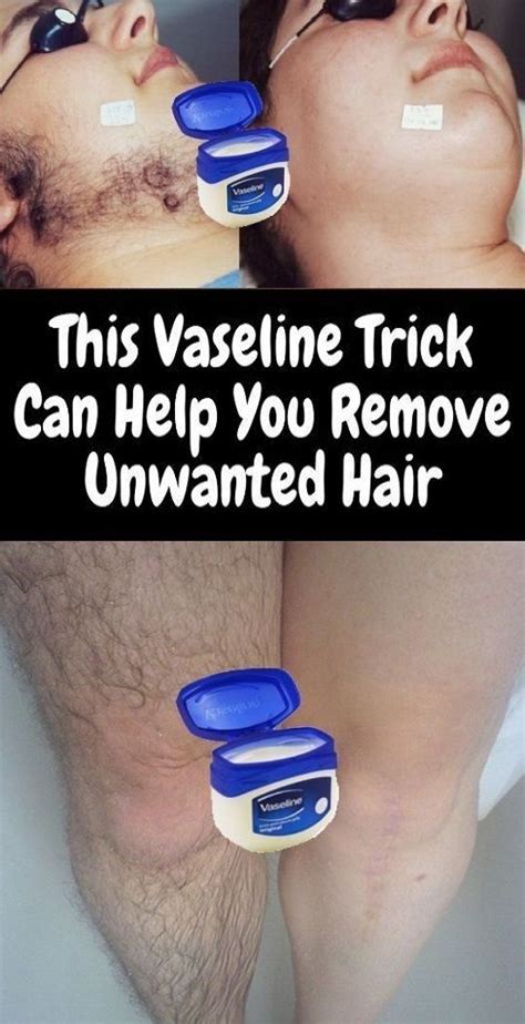 Though it may initially grow back, subsequent treatments typically provide a permanent solution. THIS VASELINE TRICK CAN HELP YOU REMOVE UNWANTED HAIR ...