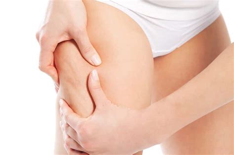 It's sometimes described as having a cottage cheese or you can see mild cellulite only if you pinch your skin in an area where you have cellulite, such as. Comment lutter efficacement contre la cellulite ? - Unof.org