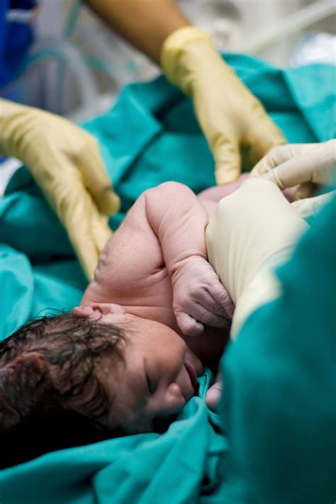 Meruang meningkatkan risiko jangkitan kuman. Sapu Kunyit & Manjakani Pada Luka Caesarean, Akibatnya ...