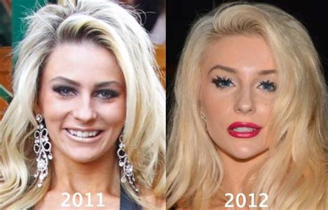 Alexis) was born in tacoma, washington, united states. Courtney-Stodden-Plastic-Surgery-before-and-after-2011 ...