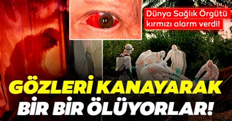 Güroymak ile ilgili haber ve etkinliklerini mi aramıştınız? Korkunç son dakika haberi: Hastalar gözleri kanayarak ölüyor! Dünya Sağlık Örgütü harekete geçti!...
