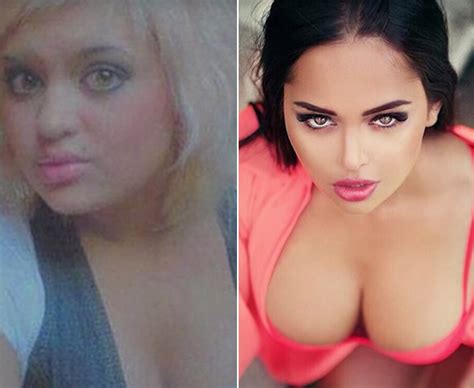 Hot Instagram models before and after plastic surgery ...