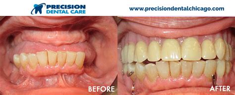 Get directions, reviews and information for precision dental care ii in chicago, il. Precision Dental Care | The Best Dentists in Chicago IL