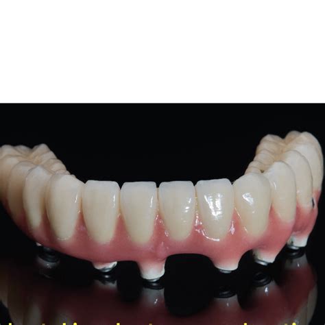 The idea behind this product is that you place a small band around the teeth you want to move each night. These are your 4 options to replace missing teeth or gaps ...