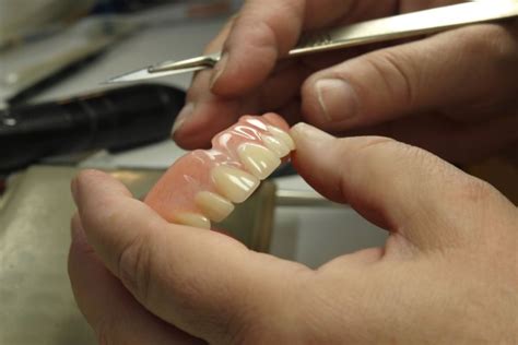 Big changes to the fit of the denture might require mailing it to a laboratory to perform the relining. Denture Repair: How Often Should You Reline Your Dentures? - Advanced Dentistry Of Walnut Creek ...