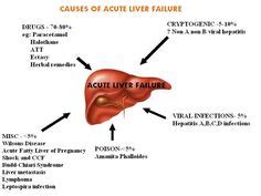 24 Latest End Stage Liver Disease ideas | liver disease, liver, liver ...